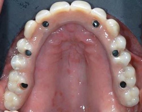 Portsmouth RI Dentist