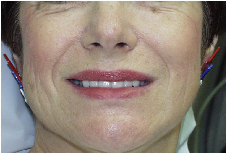 Smile Gallery Aquidneck Dental