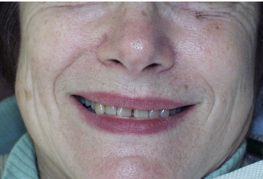 Smile Gallery Aquidneck Dental