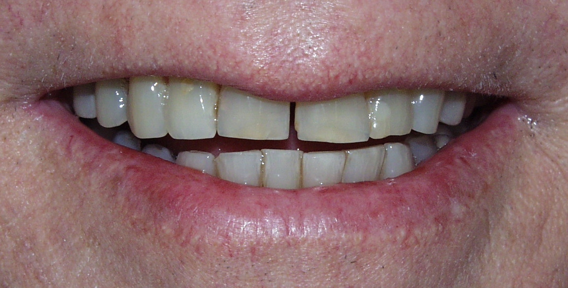 Smile Gallery Aquidneck Dental